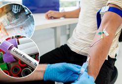 Koldan alınan bir tüp kanla kanser analizi! Onkolojide devrim gibi gelişme: 'PET'ten aylar önce anlaşılabilir...'