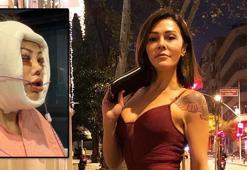 Kore'de yüz nakli yaptırmıştı! Didem Ceran hastalığını ilk kez açıkladı: Saklamak istemiyorum