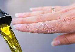 Kuru soğuktan kurtaran formül! Ellerinizi neme doyuracak, çatlama derdine son