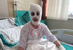 İftar vakti düdüklü tencere faciası! ‘Yüzüme elimi sürdüm, et parçası geliyordu'