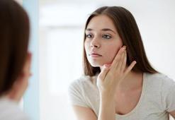 Yüz şişkinliği pek çok kişinin sorunu! Nedeni ödem mi, yanlış cilt bakımı rutini mi?