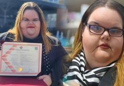 Kilosu nedeniyle zorbalık gördü, psikoloji okudu: Sıralara oturamıyordum