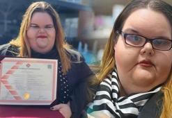 Kilosu nedeniyle zorbalık gördü, psikoloji okudu: Sıralara oturamıyordum