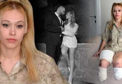 En mutlu gününde iki bacağını kaybetti! İsyan ettiren son