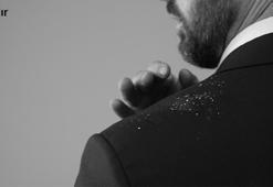 Kepeğe ve Saç Dökülmesine Karşı Şampuan Seçiminde Nelere Dikkat Edilmeli?