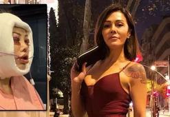 Yüz nakli yaptırmıştı! Didem Ceran’ın inanılmaz değişimi