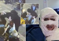 Kadıköy'de genç kadını kolonya döküp yakan Sibel Arya Geriş nedenini anlattı