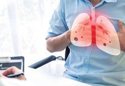 Akciğer kanserinde erken tanı hayat kurtarıyor