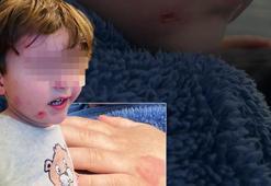 Özel kreşte skandal olay! 2,5 yaşındaki çocuk darp edildi