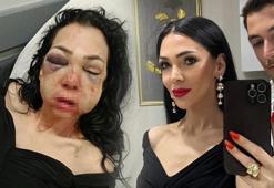 Hayatı bir günde değişti! Kocaeli'de dehşeti yaşayan kadın konuştu: Asla eskisi gibi olamayacağım