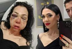 Kocaeli'de dehşeti yaşayan kadın konuştu: Asla eskisi gibi olamayacağım