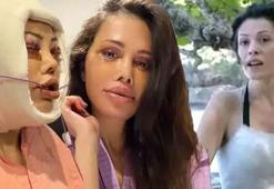 Yüz nakli olan Didem Ceran son halini paylaştı! ‘Bebeksiliğim yapay zeka değil’