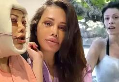 Yüz nakli olan Didem Ceran son halini paylaştı! ‘Bebeksiliğim yapay zeka değil’