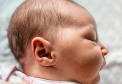 Kepçe kulak, özgüven sorunlarına yol açıyor! Ameliyatsız da tedavisi mümkün