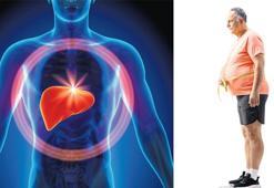 Küresel salgın: Karaciğer yağlanması