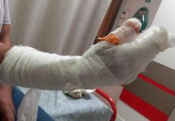 Kocaeli’de skandal iddia: Tedavi sonrası parmağı ampute edildi, kolunda metal bulundu
