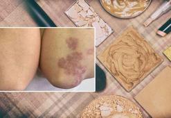 Popüler makyaj trendi ölümüne sebep oluyordu! Tüm vücudunu sardı