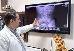 Ameliyattan çıkan doktor şaşkın: Böylesini hiç görmedim