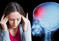 Sıradan sandı, hayatı değişti! Baş ağrısı beyin kanaması çıktı