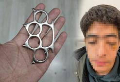 Esenyurt’ta akran dehşeti! Gözünü kaybetme riskiyle ameliyata alınan çocuğun yüz kemikleri kırıldı