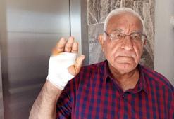 Asansörde korkunç saldırı! Komşusu parmağını ısırarak kopardı: Onu çok severdim, niçin yaptı anlamadım