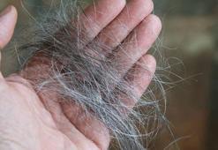 Kirli fırça yağın en büyük sebebi! Sık temizlemeyince herkes aynı sorunu yaşıyor, dermatologlar uyardı