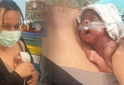 Mucize bebek Leyloş, kep ve cübbeyle taburcu oldu: Küçücüktü, tutamadım bile