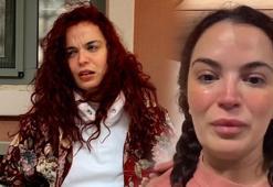 7 kez ameliyat olmuştu! Aslı Bekiroğlu'nun başı beladan kurtulmuyor: Şimdi de ayağından sakatlandı
