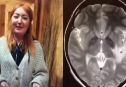 Hindistan gezisi sonrası kabusu yaşadı! Beyninde 38 adet tespit edildi