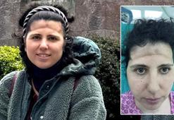 3 boyutlu teknoloji mucizesi! Alnındaki çöküklük tarih oldu