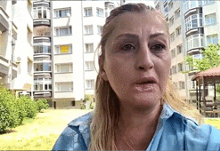 Dolgu yaptırdığı dudağı çürüdü! 'Gülüşüm yok, yemek yemem problem'