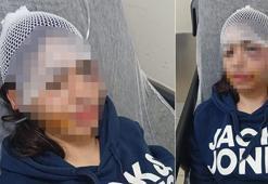 Ayrılık kararını kabullenemeyip kız arkadaşına dehşeti yaşattı