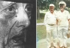 Bir başladı, 68 yıl hiç durmadı! Dünyanın en uzun süre hıçkıran insanı: 430 milyonu aştı