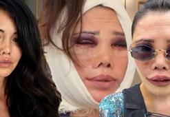İkinci kez yüz nakli olmuştu! Didem Ceran’dan peş peşe çarpıcı açıklamalar: Hiç kimsem yok, tek başıma savaşıyorum