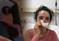 Eşi tarafından burnu ısırılıp koparılan İmran dehşeti anlattı: Acıyla balkondan atlamayı düşündüm