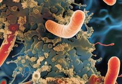 Peynirde Listeria alarmı