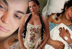 Aslı Bekiroğlu 8. kez ameliyat oluyor: Son İnşallah