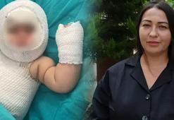 9 aylık bebeğin başına gelen kabus! Her şey köpeğin emziği almasıyla başladı