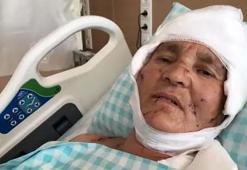 Köpek saldırısında emsal karar! Yargıtay 637 bin liralık tazminatı onadı