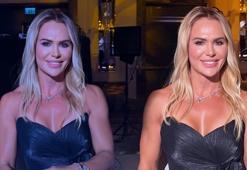 Estetiğe servet ödemişti! Survivor Nagihan Karadere son haliyle dikkat çekti