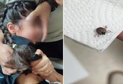 Bir aydır kulak ağrısı çekiyordu! Kulağında canlı kene bulundu