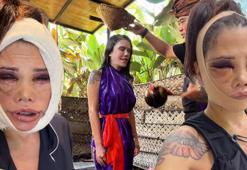 Yüz nakli hayatını kabusa çevirmişti! Survivor Didem Ceran'dan arınma ritüeli