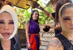 Yüz nakli hayatını kabusa çevirmişti! Survivor Didem Ceran'dan arınma ritüeli