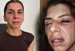 Eşi tarafından 4 saat işkence gördü, boğazına bıçak dayandı