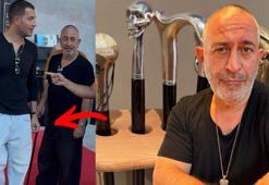 Elinde bastonla görüntülenen Cem Yılmaz'dan yanıt geldi: Allah Allah baston derken?!