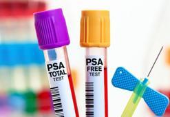Erkeklerin prostat sınavı: PSA’ya bakıp rahatlamayın!
