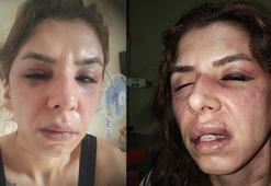 İstanbul’da dehşet! Eşini saatlerce darbedip bıçakla tehdit ettiği iddiası: 'Şehadet getir'