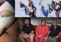 Zincir, keser, sopa ve bıçak... İki ailenin meydan savaşı: Mangal yapıp bize gıcıklık veriyorlar