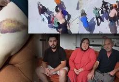 İki ailenin meydan savaşı: Mangal yapıp bize gıcıklık veriyorlar
