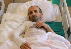 Sıcak suda yandı, kesilmekten kurtarıldı! Epilepsi hastasına acil müdahale